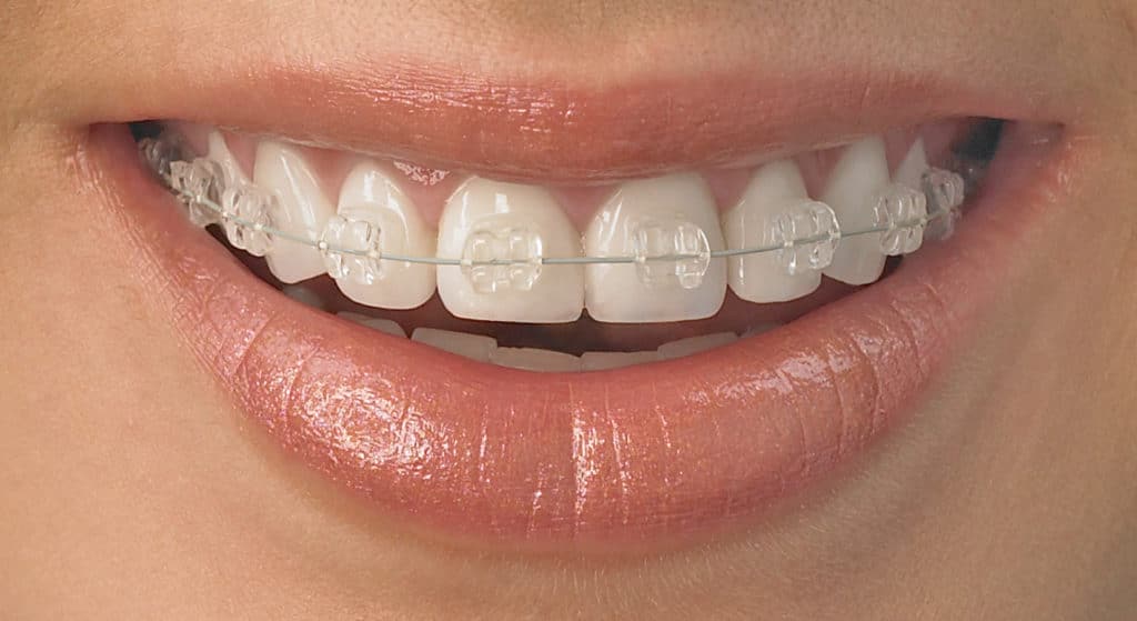 Ortodontia – Dra. Fabiola Zanin